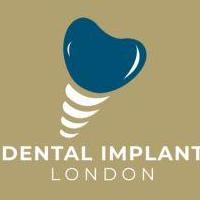 Dental Implants London